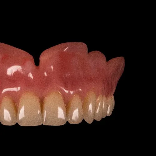 Hate_Dentalia